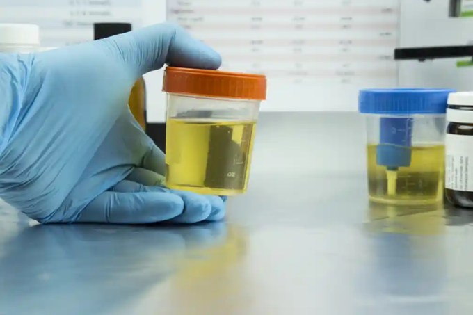 DOT drug testing rules keep observed urine testing in place for certain truck driver tests as oral fluid testing remains delayed by lab availability.